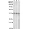 PHD Finger Protein 11 (PHF11) Antibody