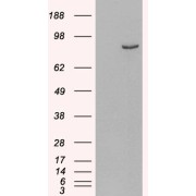 HEK293 overexpressing Human PDE4B and probed with abx433131 (mock transfection in first lane).