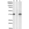 Pim-2 Oncogene (PIM2) Antibody