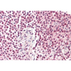 Pirin (PIR) Antibody