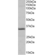 abx433137 (0.3 µg/ml) staining of Human Heart lysate (35 µg protein in RIPA buffer). Detected by chemiluminescence.