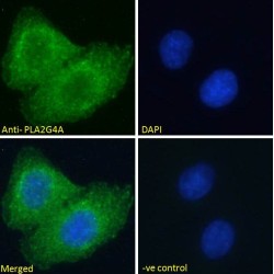 Cytosolic Phospholipase A2 (PLA2G4A) Antibody