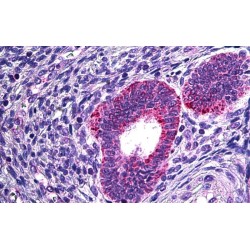 Cytosolic Phospholipase A2 (PLA2G4A) Antibody