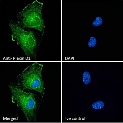 Plexin D1 (PLXND1) Antibody