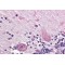 Serine/Threonine-Protein Phosphatase 2A Regulatory Subunit B (PPP2R3A) Antibody