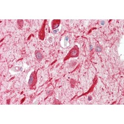 Protein Phosphatase 2 Regulatory Subunit B'Alpha (PPP2R5A) Antibody