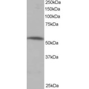 abx433168 staining (0.5 µg/ml) of human muscle lysate (RIPA buffer, 35 µg total protein per lane). Primary incubated for 1 hour. Detected by western blot using chemiluminescence.