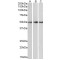 Protein Phosphatase 2 Regulatory Subunit B'Epsilon (PPP2R5E) Antibody