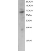 abx433171 staining (2 µg/ml) of Jurkat lysate (RIPA buffer, 30 µg total protein per lane). Primary incubated for 12 hour. Detected by western blot using chemiluminescence.