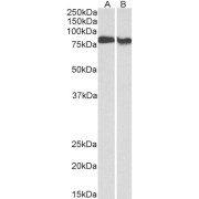 abx433179 (0.3 µg/ml) staining of Human Placenta (A) and Rat Brain (B) lysates (35 µg protein in RIPA buffer). Primary incubation was 1 hour. Detected by chemiluminescence.