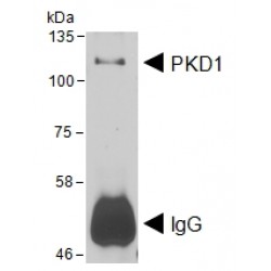 Protein Kinase D1 (PRKD1) Antibody