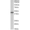 Pentatricopeptide Repeat-Containing Protein 2, Mitochondrial (PTCD2) Antibody