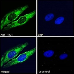Protein Patched Homolog 1 (PTCH) Antibody