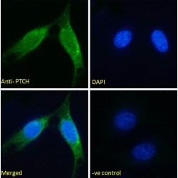 Protein Patched Homolog 1 (PTCH) Antibody