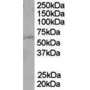 abx433197 (1 µg/ml) staining of A431 lysate (35 µg protein in RIPA buffer). Primary incubation was 1 hour. Detected by chemiluminescence.