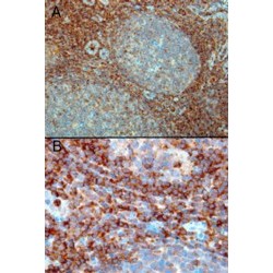 Ras-Related C3 Botulinum Toxin Substrate 2 (RAC2) Antibody