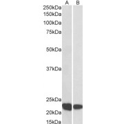 abx433210 (0.1 µg/ml) staining of Human Thymus (A) and Tonsil (B) lysate (35 µg protein in RIPA buffer). Primary incubation was 1 hour. Detected by chemiluminescence.
