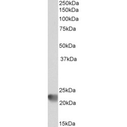 Ras-Related C3 Botulinum Toxin Substrate 2 (RAC2) Antibody