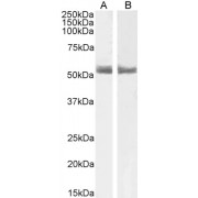 abx433215 (1 µg/ml) staining of Human Breast (A) and Breast cancer (B) lysate (35 µg protein in RIPA buffer). Primary incubation was 1 hour. Detected by chemiluminescence.