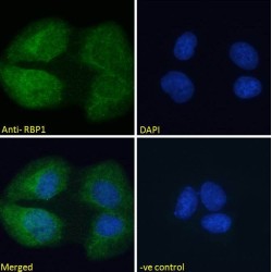 Retinol-Binding Protein 1 (RBP1) Antibody