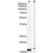 abx433219 (2 µg/ml) staining of NIH3T3 (A) and (0.5 µg/ml) of U251 (B) cell lysate (35 µg protein in RIPA buffer). Detected by chemiluminescence.