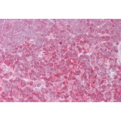 Proto-Oncogene C-Rel (REL) Antibody