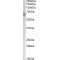 Retinoid Isomerohydrolase (RPE65) Antibody