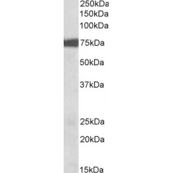 Ribosomal Protein S6 Kinase A2 (RPS6KA2) Antibody