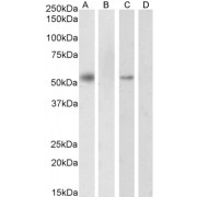 abx433241 (0.3 µg/ml) staining of nuclear HeLa cell lysate (A) + peptide (B) and nuclear K562 cell lysate (C) + peptide (D). (35 µg protein in RIPA buffer). Detected by chemiluminescence.