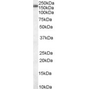 abx433249 staining (0.01 µg/ml) of Jurkat cell lysate (RIPA buffer, 30 µg total protein per lane). Primary incubated for 1 hour. Detected by chemiluminescence.