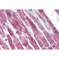 Succinate Dehydrogenase Complex Subunit B (SDHB) Antibody