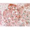 Semaphorin 3E (SEMA3E) Antibody