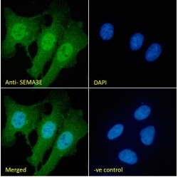 Semaphorin 3E (SEMA3E) Antibody