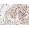 SLC22A16 Antibody