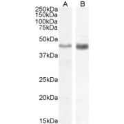 abx433283 (0.5 µg/ml) staining of Human (A) and (1 µg/ml) Mouse (B) Duodenum lysate (35 µg protein in RIPA buffer). Detected by chemiluminescence.