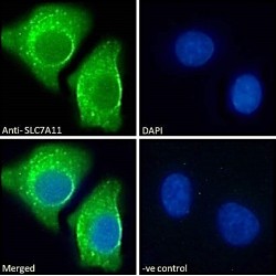 Cystine/Glutamate Transporter (SLC7A11) Antibody