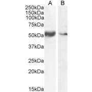 abx433286 (0.1 µg/ml) staining of Human Smooth Muscle (A) and Tonsil (B) lysate (35µg protein in RIPA buffer). Detected by chemiluminescence.