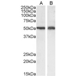 Cystine/Glutamate Transporter (SLC7A11) Antibody