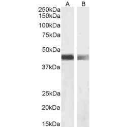 Actin Alpha 2, Smooth Muscle (ACTA2) Antibody