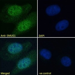 Single Strand Selective Monofunctional Uracil DNA Glycosylase 1 (SMUG1) Antibody