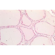 abx433310 (5 µg/ml) staining of paraffin embedded Human Prostate. Steamed antigen retrieval with citrate buffer pH 6, AP-staining.