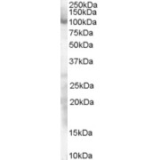 abx433312 staining (0.3 µg/ml) of HeLa lysate (RIPA buffer, 30 µg total protein per lane). Detected by chemiluminescence.