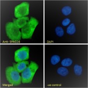 Immunofluorescence analysis of paraformaldehyde fixed A431 cells, permeabilized with 0.15% Triton. Primary incubation 1hr (10 µg/ml) followed by AF488 secondary antibody (2 µg/ml), showing cytoplasmic staining. The nuclear stain is DAPI (blue). Negative control: Unimmunized goat IgG (10 µg/ml) followed by AF488 secondary antibody (2 µg/ml).