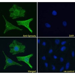 Sprouty Antibody