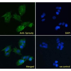 Sprouty Antibody