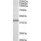 Suppressor of Variegation 3-9 Homolog 2 (SUV39H2) Antibody