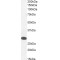 Tafazzin (TAZ) Antibody