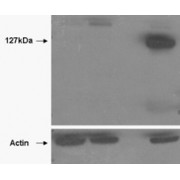 HEK293 overexpressing TANK2 (lane 4) and TANK1 (lane 2) and probed with abx433341 (mock transfection in first lane). Lane three is empty. Lower panel shows the same lysates probed for alpha-Actin to show protein levels. Primary incubation (0.5 µg/ml) was overnight at 4°C. Detected by chemiluminescence.