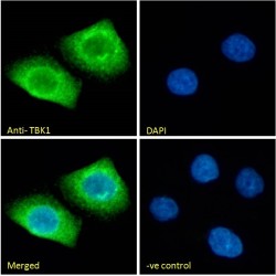Serine/threonine-Protein Kinase TBK1 (TBK1) Antibody