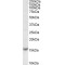 T-Cell Leukemia/lymphoma Protein 1A (TCL1A) Antibody